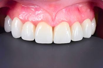 After -Moltons Dental