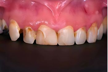 Before - Moltons Dental