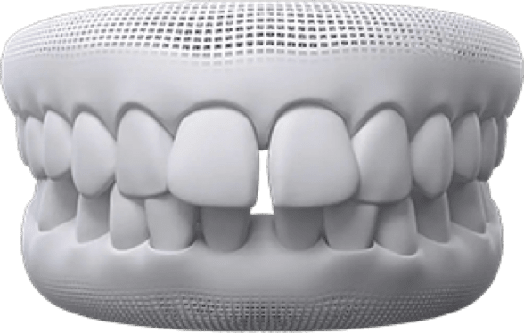 Invisalign Fix Icon