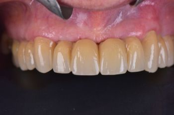 After -Moltons Dental