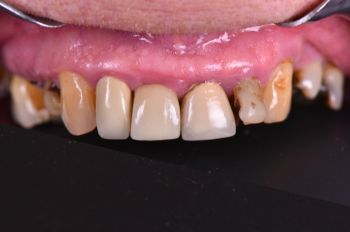 Before - Moltons Dental