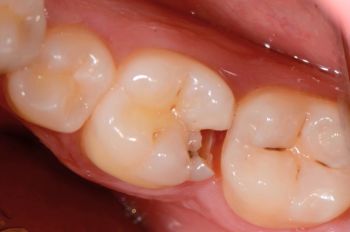 Before - Moltons Dental