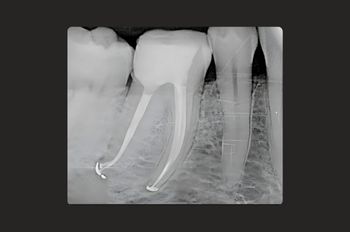 After -Moltons Dental