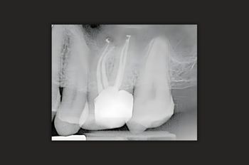 After -Moltons Dental