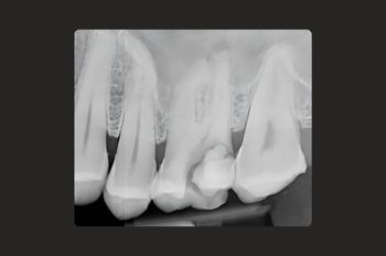 Before - Moltons Dental