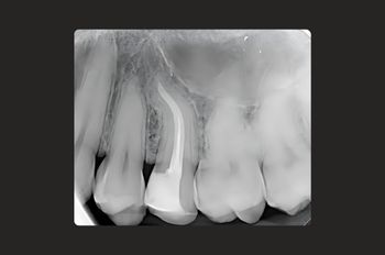 After -Moltons Dental