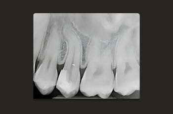 Before - Moltons Dental