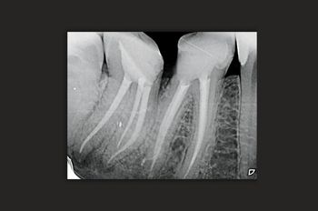 After -Moltons Dental