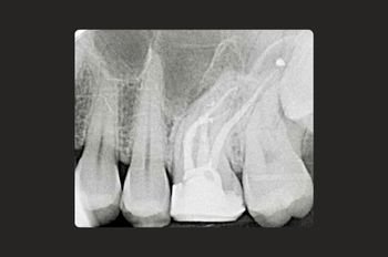 After -Moltons Dental