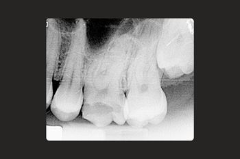 Before - Moltons Dental