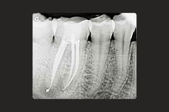 After -Moltons Dental