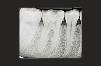 Before - Moltons Dental