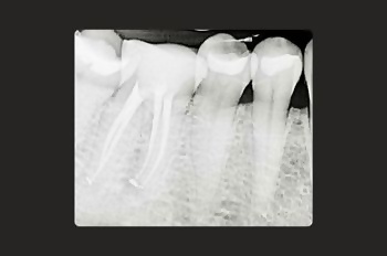 After -Moltons Dental