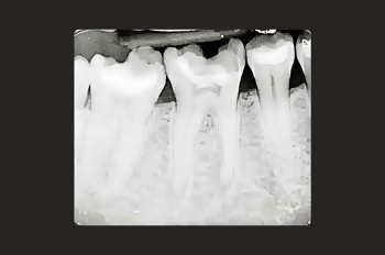 Before - Moltons Dental