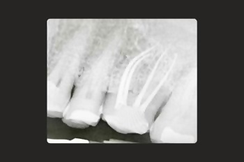 After -Moltons Dental