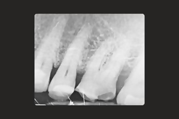 Before - Moltons Dental