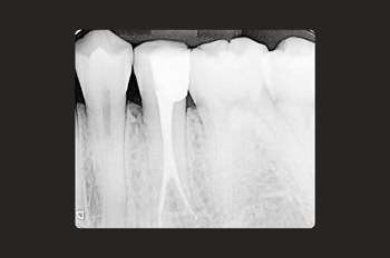 After -Moltons Dental