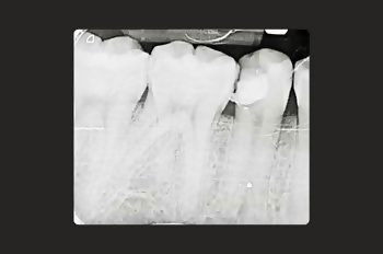 Before - Moltons Dental