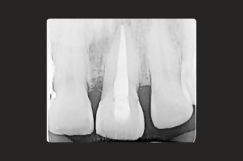 After -Moltons Dental