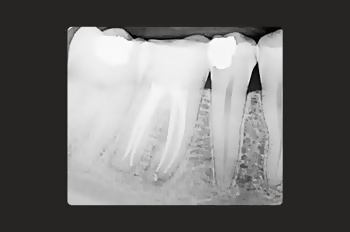 After -Moltons Dental