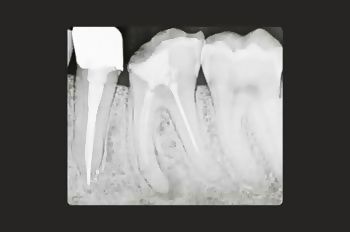 Before - Moltons Dental