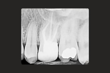 After -Moltons Dental