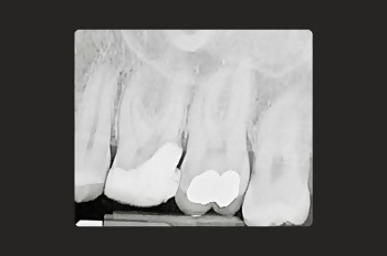 Before - Moltons Dental