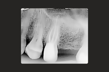 After -Moltons Dental