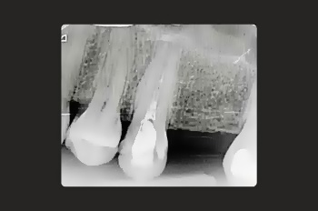 Before - Moltons Dental