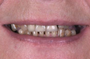 Before - Moltons Dental