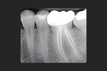 After -Moltons Dental