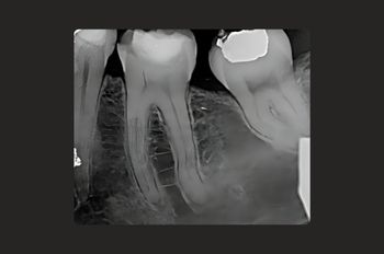 Before - Moltons Dental