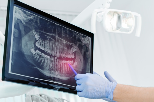 Blog -Moltons Dental